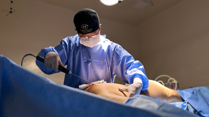 A lipoaspiração tradicional e a lipo HD possuem diferenças técnicas e indicações específicas, destaca Milton Seigi Hayashi.